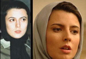  عکس قبل و بعد از عمل لیلا حاتمی
