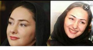  عکس قبل و بعد از عمل هانیه توسلی